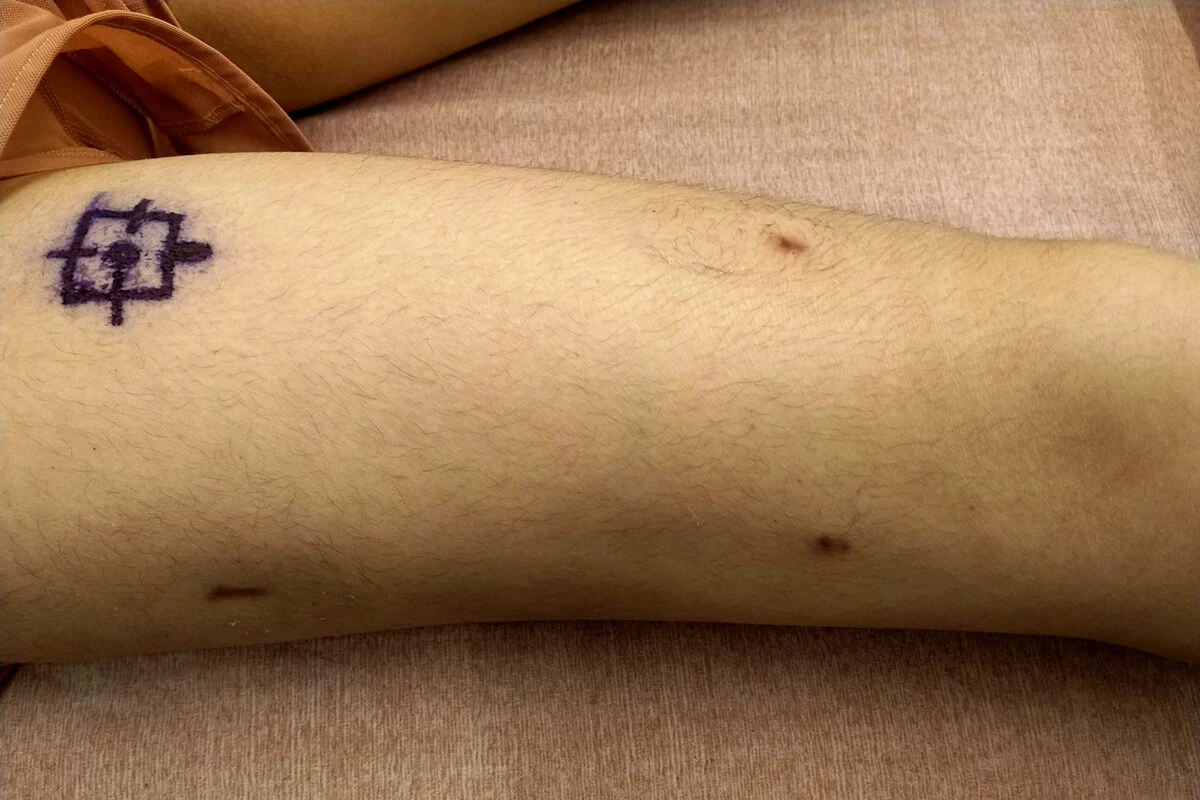 scar 4